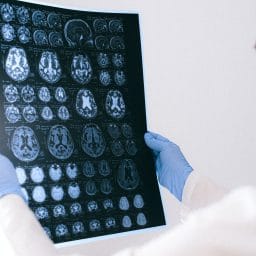 Doctor looking at MRI.